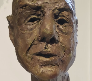 متحف اسكتلندي يعرض تمثالًا لتكريم الطبيب حسام أبو صفية