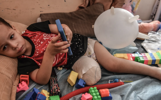 طفل بترت رجله من القصف الإسرائيلي على غزة