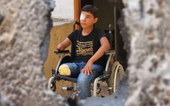 طفل مصاب في قطاع غزة