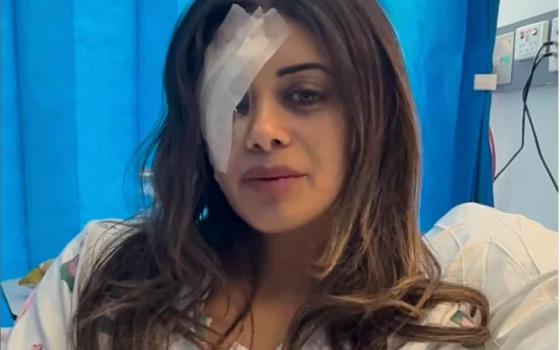 "مهددة بفقدان البصر".. إسقاط تهمة عن متظاهرة أسترالية مؤيدة لفلسطين