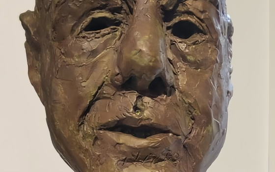 متحف اسكتلندي يعرض تمثالًا لتكريم الطبيب حسام أبو صفية