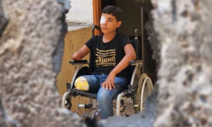 طفل مصاب في قطاع غزة